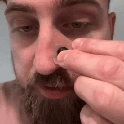 Dilatador Nasal Magnético